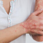 Marla Ahlgrimm on Systemic Inflammation